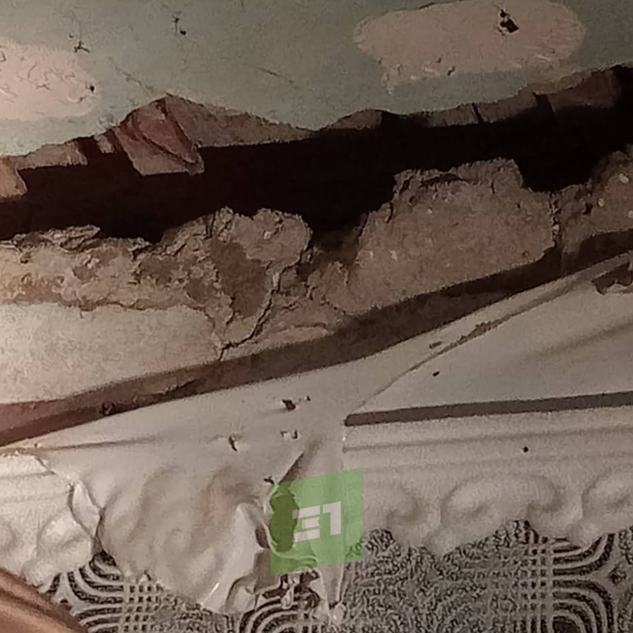 Получил 70% ожогов тела во время утепления подвала