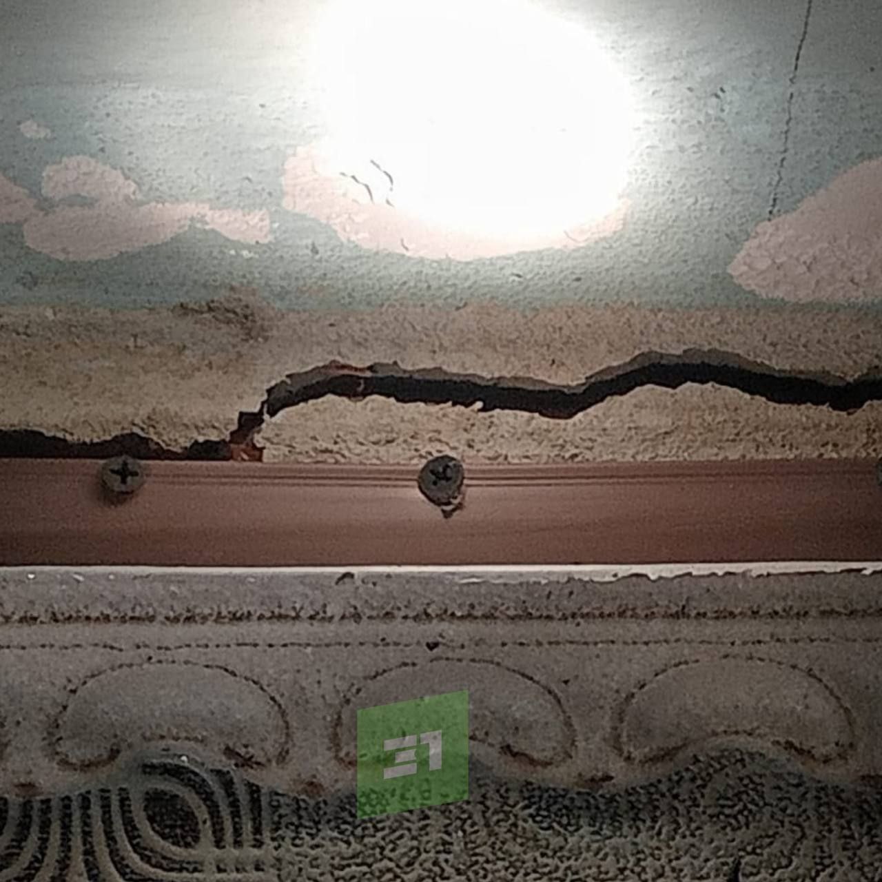 Получил 70% ожогов тела во время утепления подвала Получил 70% ожогов тела во время утепления подвала