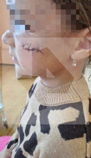 В Челябинске шестилетняя девочка рассекла щеку на празднике в игровой комнате