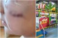 В Челябинске девочка получила травму во время празднования дня рождения в игровой комнате