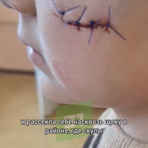 «Мы приводим их туда, чтобы они веселились, а не получали травмы на всю жизнь!»