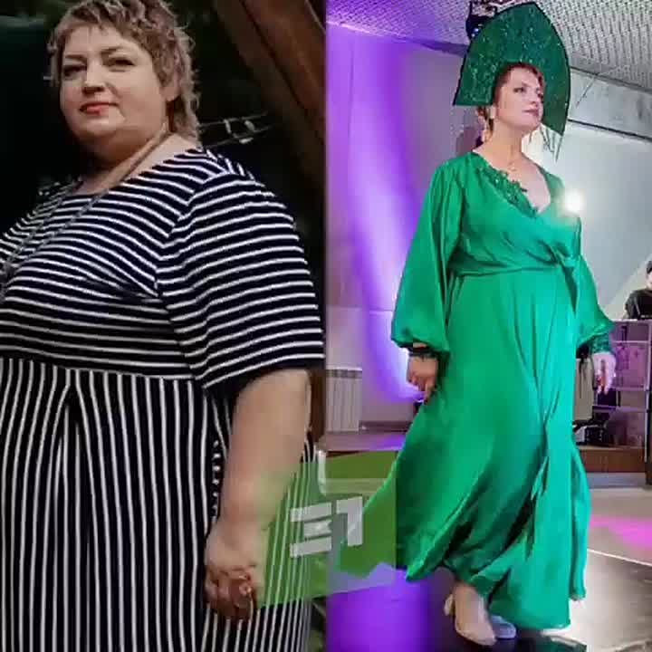 Медики помогли жительнице Кыштыма похудеть на 70 кг