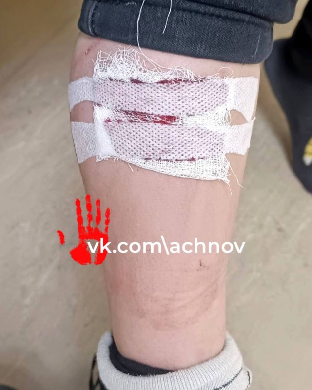 Прокуратура Аргаяшского района провела проверку по публикации СМИ о нападении бродячей собаки на малолетнего ребенка