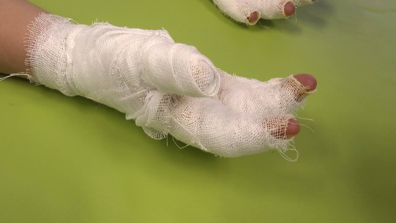 1234 Обморожения и переломы: об опасностях зимних развлечений рассказали врачи из Челябинска 1234 Обморожения и переломы: об опасностях зимних развлечений рассказали врачи из Челябинска