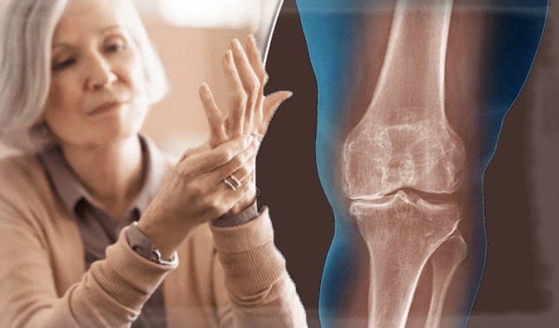 Как сохранить здоровье костей после 55 лет: полезные советы и предупреждения