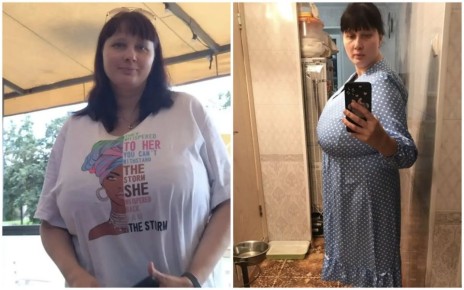 После измены мужа у челябинки выросла гигантская грудь