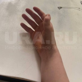 Клиент сломал палец сотруднику салона красоты