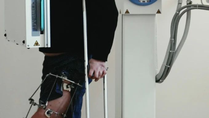 Юлия Сударенко добилась госпитализации бойца, отправленного на передовую с аппаратом Илизарова
